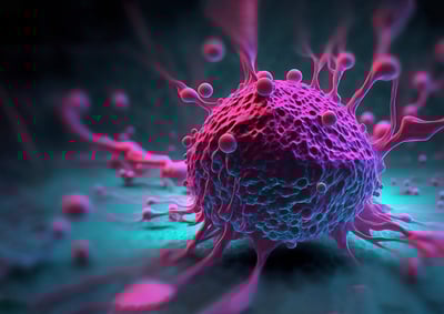 PrecAQ_AItransformingCancerCare_blog_06202025